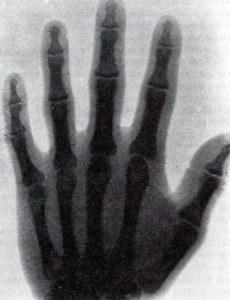 First X-Ray photo in U.S.
